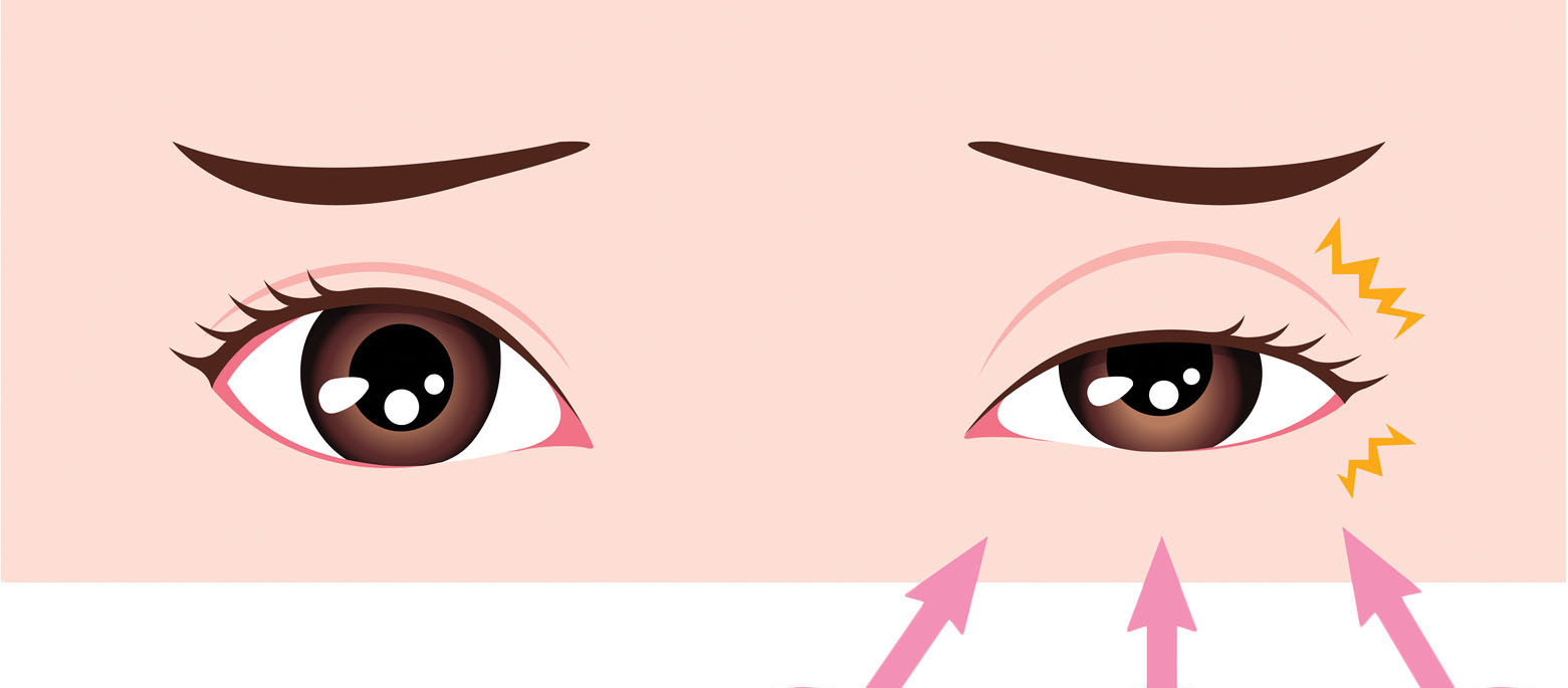Why does my eye twitch randomly: main illustration