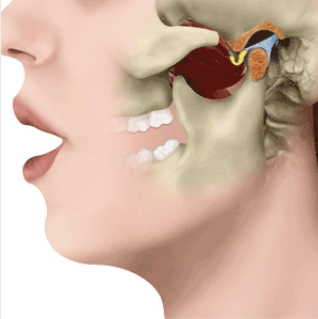 Why does my jaw pop when i open my mouth: main illustration