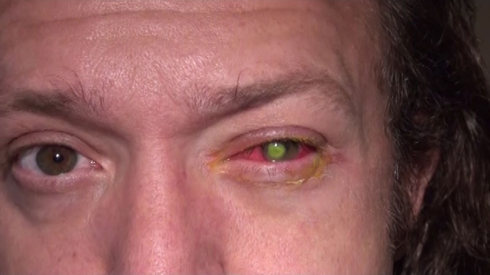 What happens if you fall asleep with contacts: main illustration