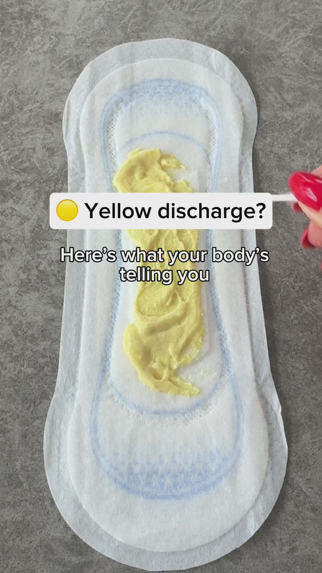 Is it normal for discharge to be yellow: example and key details