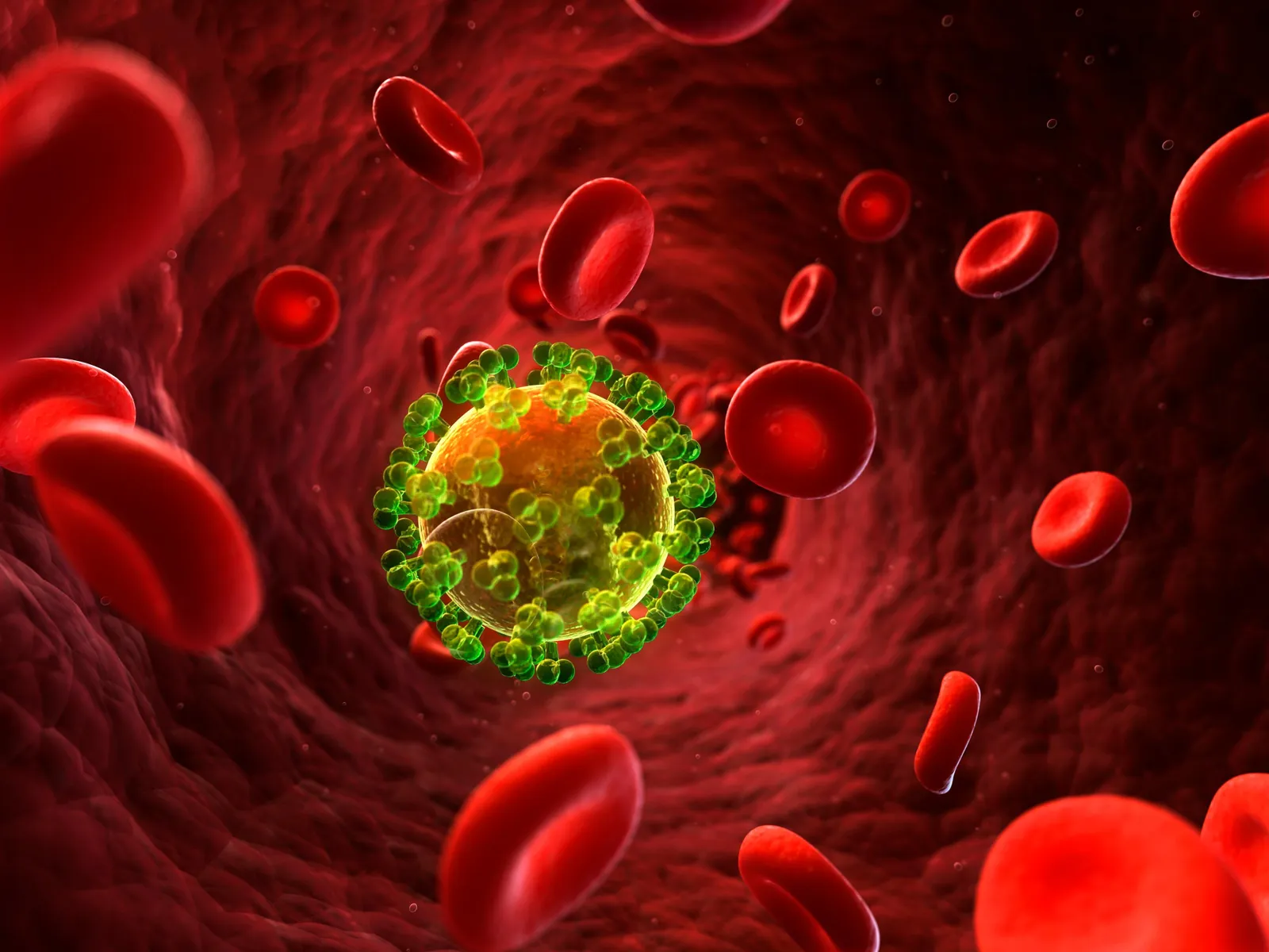 What causes hiv aids: example and key details