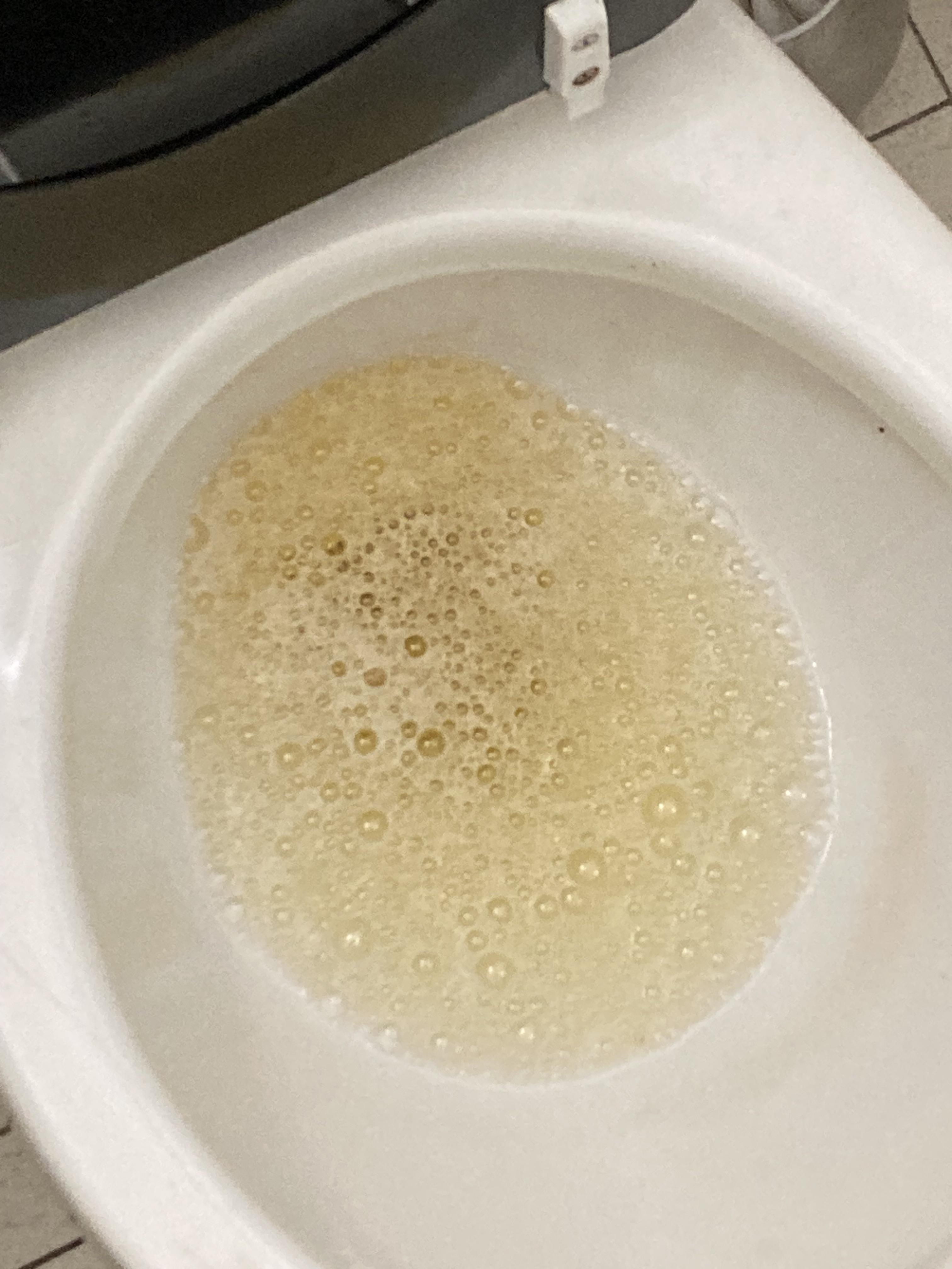 Why do i have bubbles in my urine: visual explanation