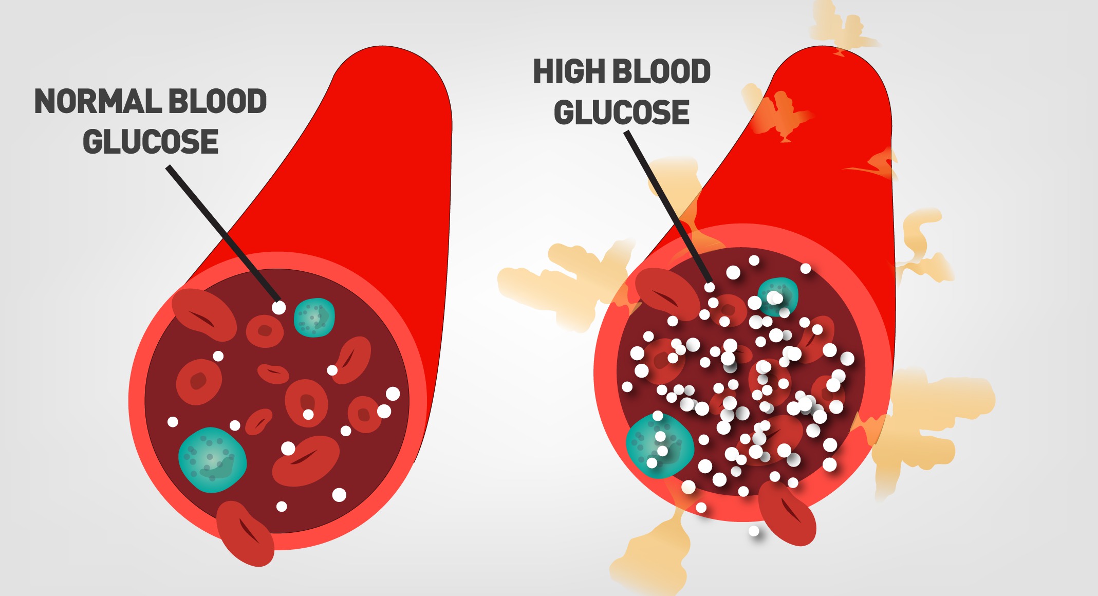 What happens if blood glucose is too high: main illustration