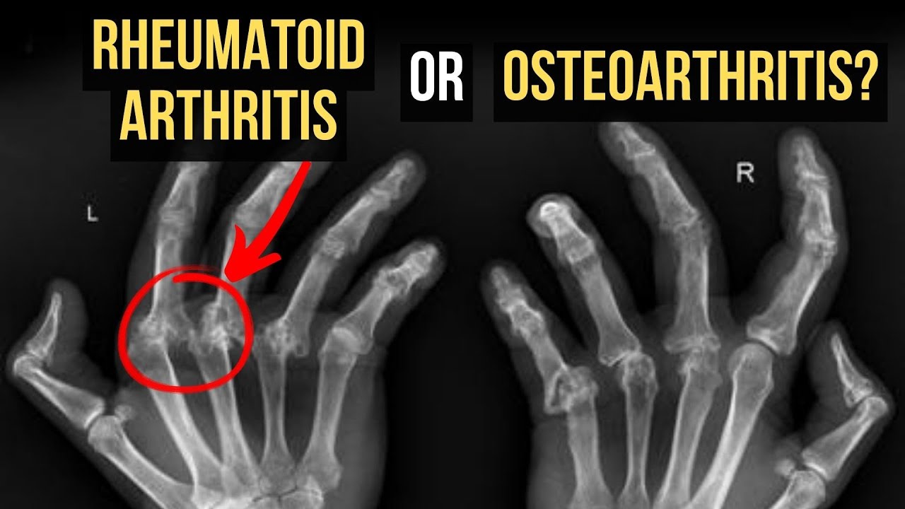 Difference between ra and oa: visual explanation