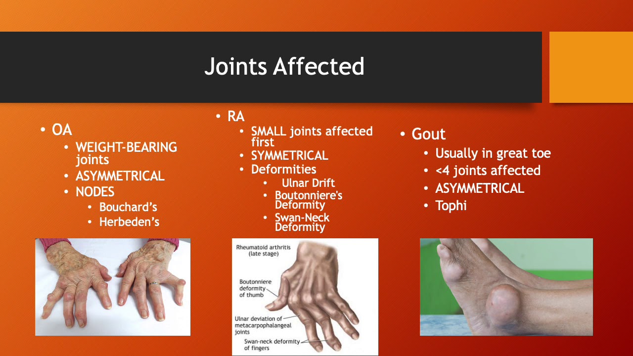 Difference between ra and oa: example and key details
