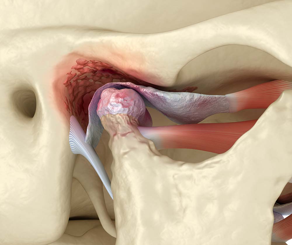 Why does my jaw crack when i chew: main illustration