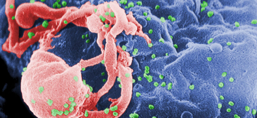 HIV_primary
