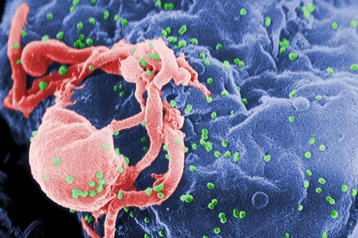 What causes hiv aids: main illustration