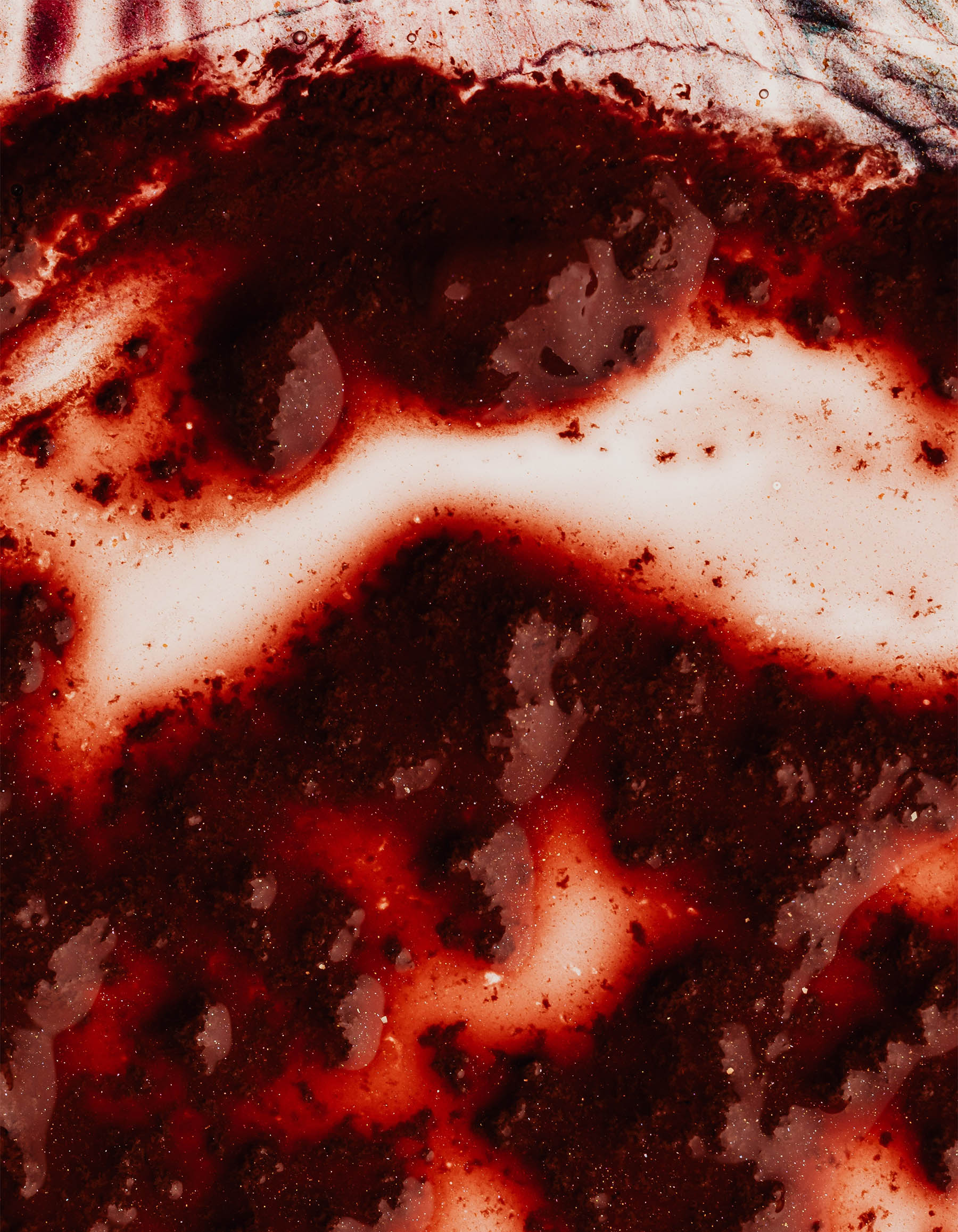 Is it normal to have blood clots on period: example and key details