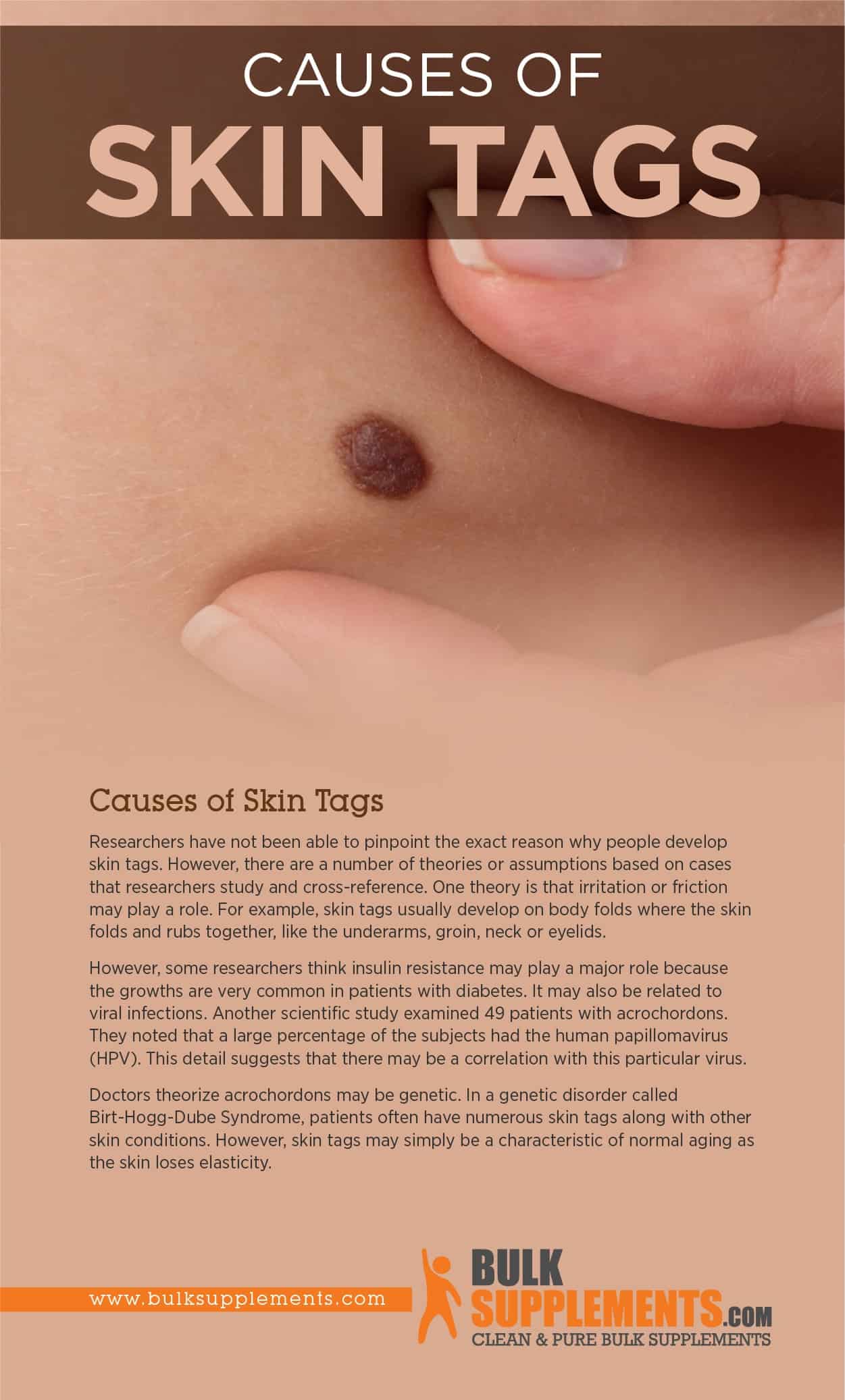 Why do i get skin tags: main illustration