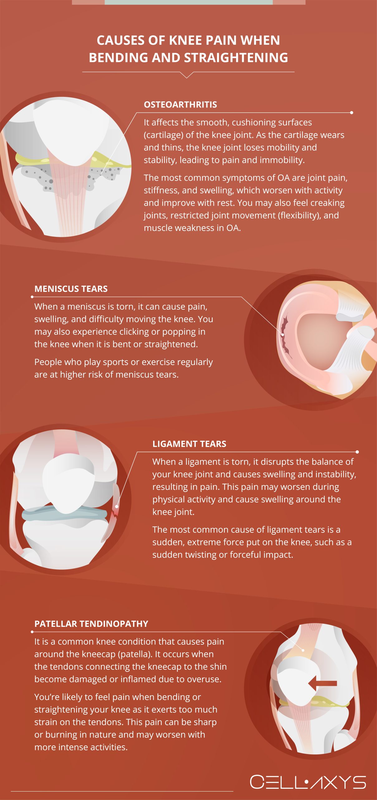 Why do my knees hurt when i walk: example and key details