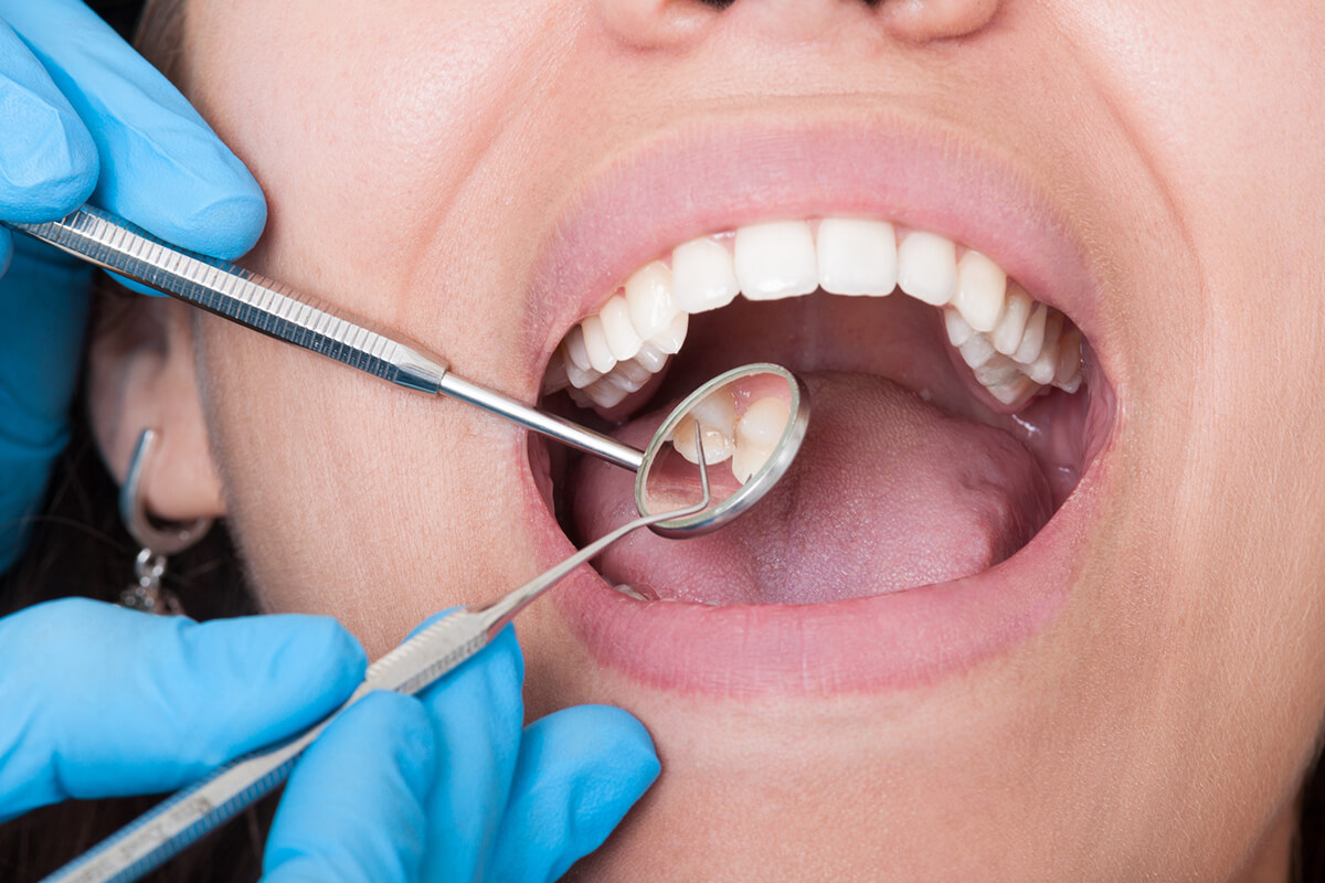 How long do teeth cleanings take: example and key details