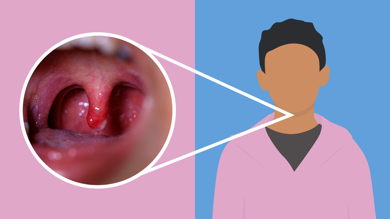 Why does one side of my throat hurt: example and key details