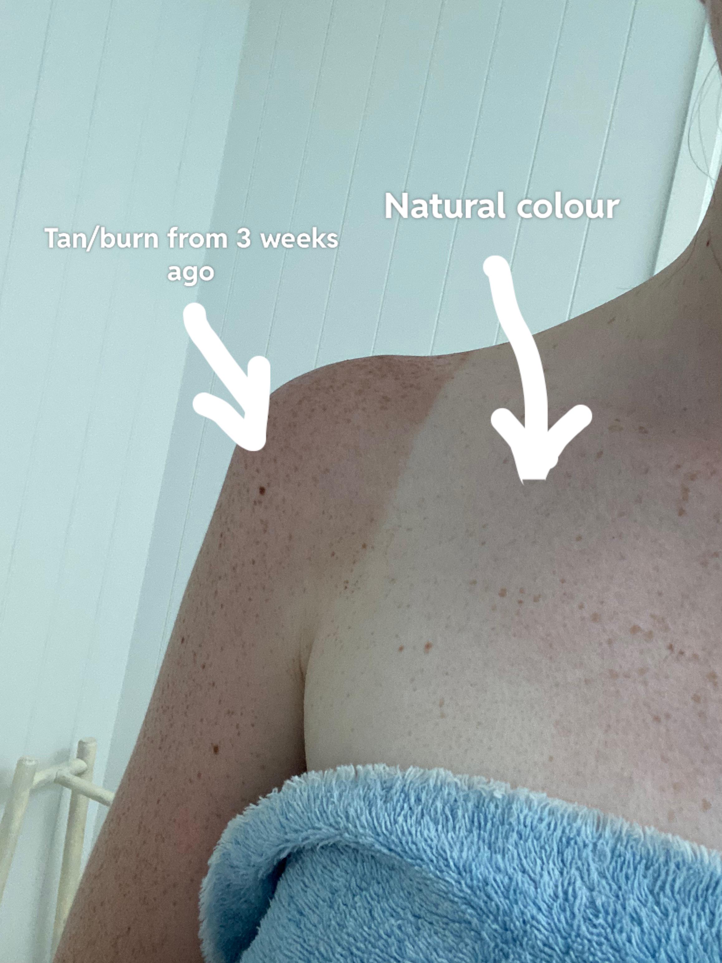 How long does a suntan last: main illustration