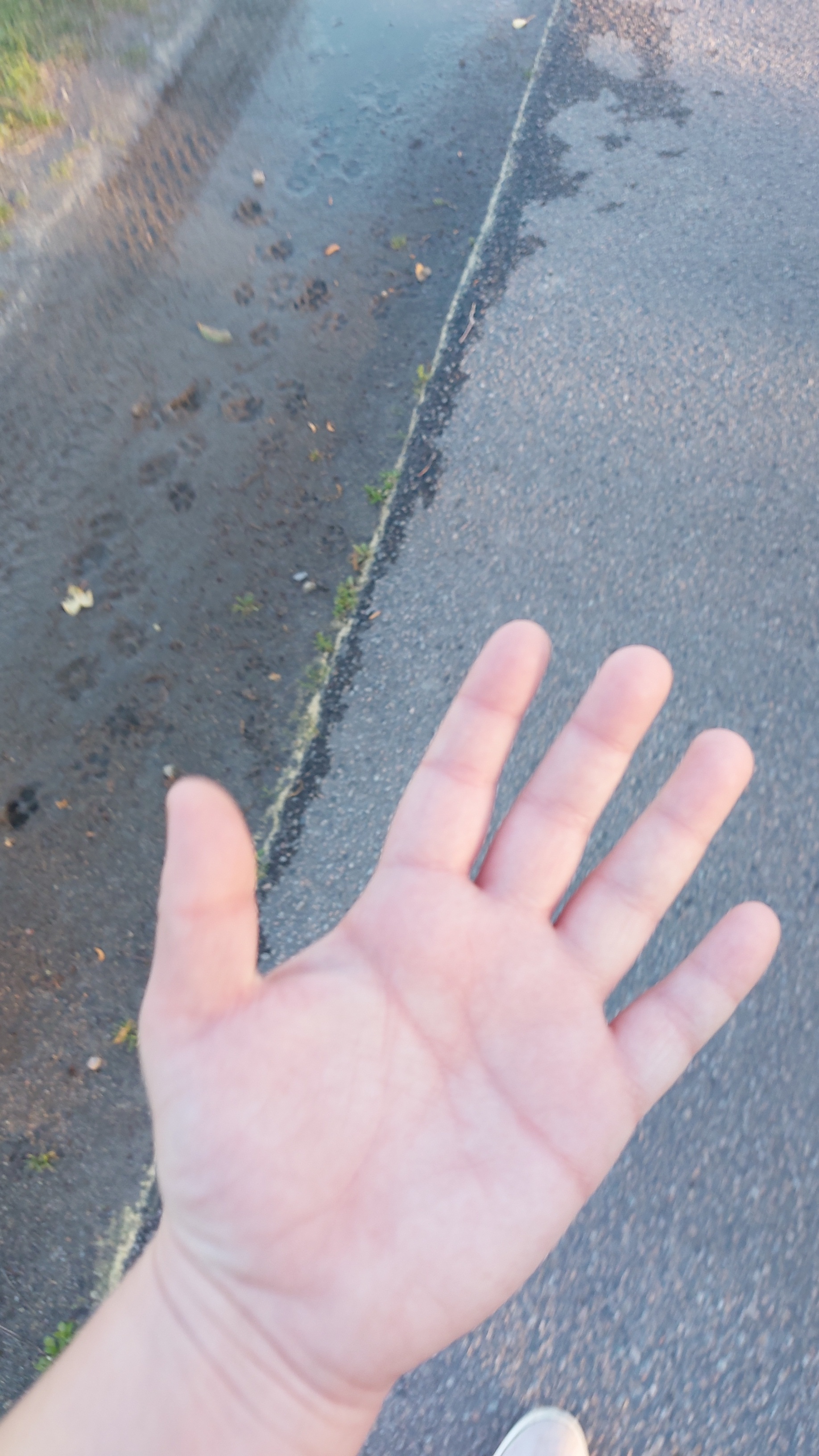 Why do my fingers swell when walking: main illustration