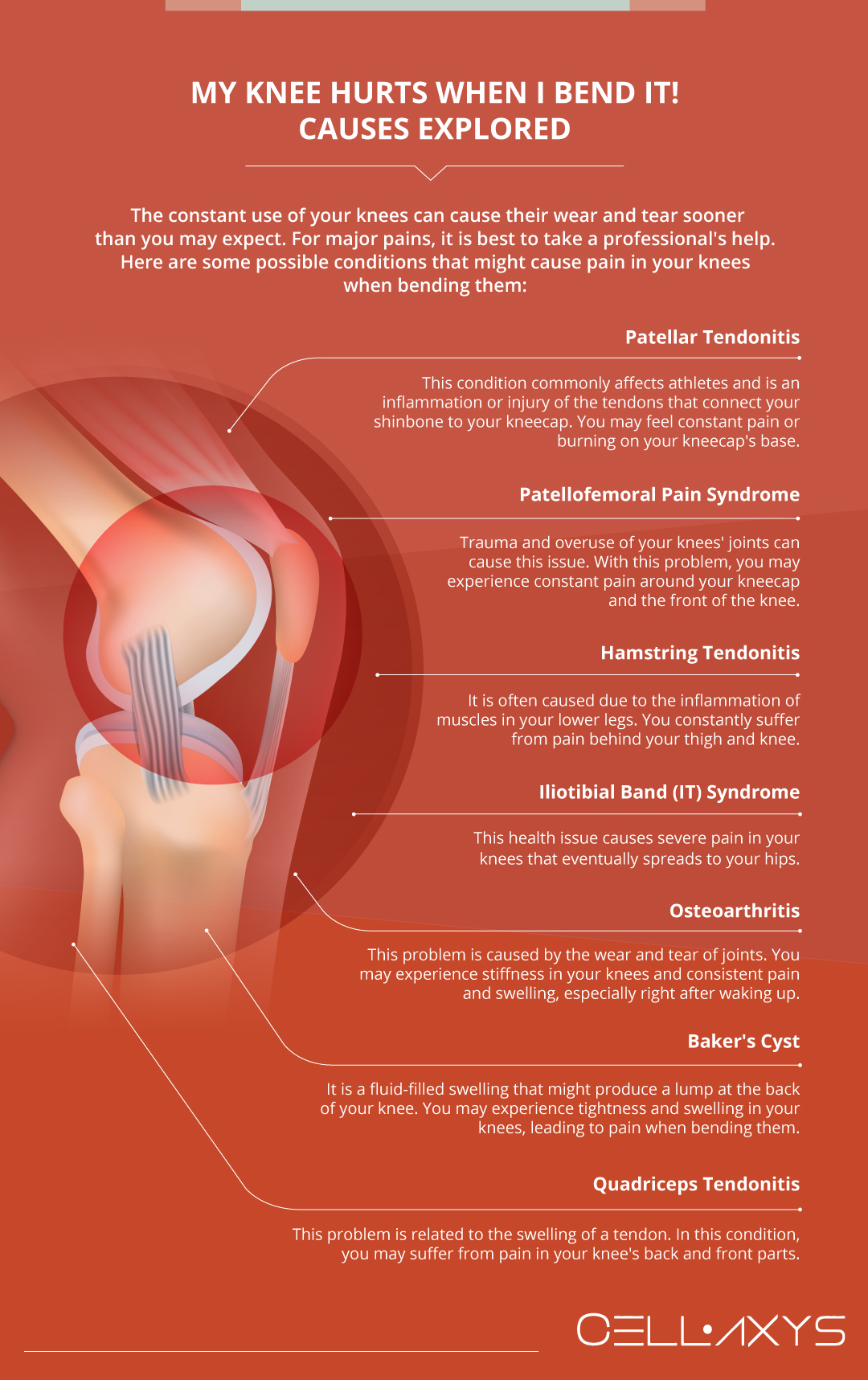 Why do my knees hurt when i walk: main illustration