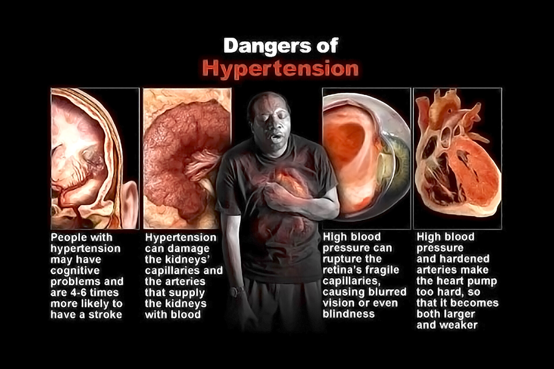 What causes and enlarged heart: main illustration