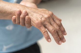 Guillain-Barre Syndrome GBS, Peripheral Neuropathy pain in elderly patient on hand, fingers, sensory nerves with numb, muscle weakness from chronic inflammatory demyelinating polyneuropathy