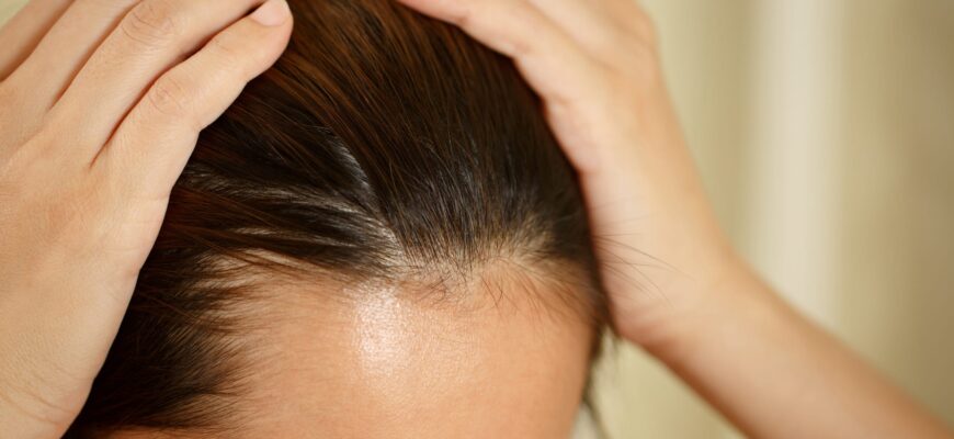 woman-has-problems-with-hair-and-scalp-royalty-free-image-1708634175