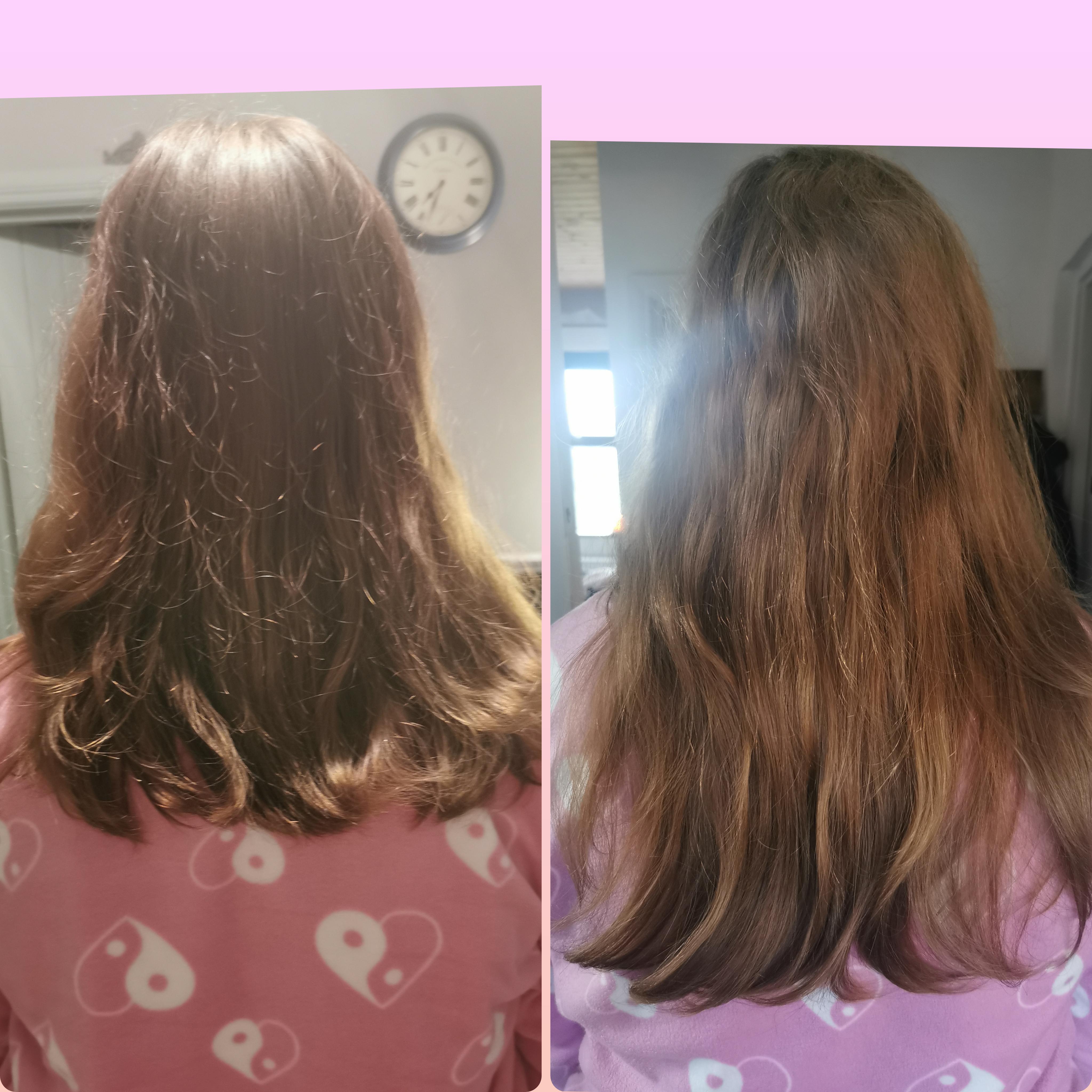 Why does my hair grow so quickly: example and key details